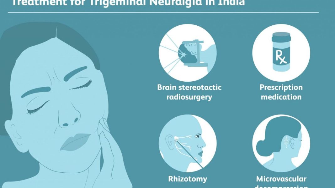 Trigeminal Neuralgia Tablet