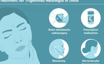 Trigeminal Neuralgia Tablet